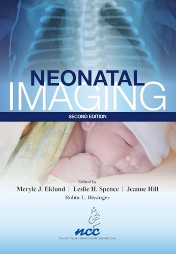 Amazon.com: Handbook of Neonatal Neurology, 1st edition